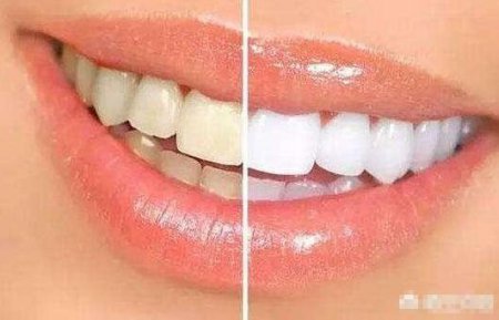 牙齿很黄 牙齿很黄怎么变白的简单方法